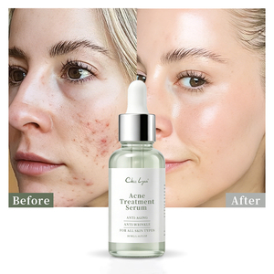 Anti Acne Face Serum Niacinamide Organic Salicylic Acid